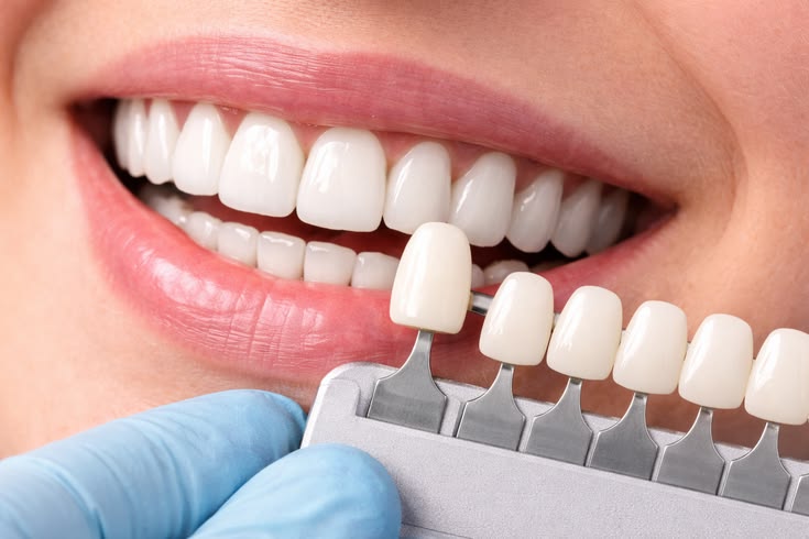 smile designing in chromepet,hasthinapuram