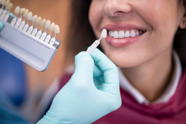 whitening boost,veeners treatment in chitlapakkam,hasthinapuram,chromepet area
